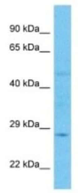 ELA2A Rabbit anti-Human, Polyclonal, Novus Biologicals 100 &mu;g | Buy Online | Novus Biologicals | Fisher Scientific